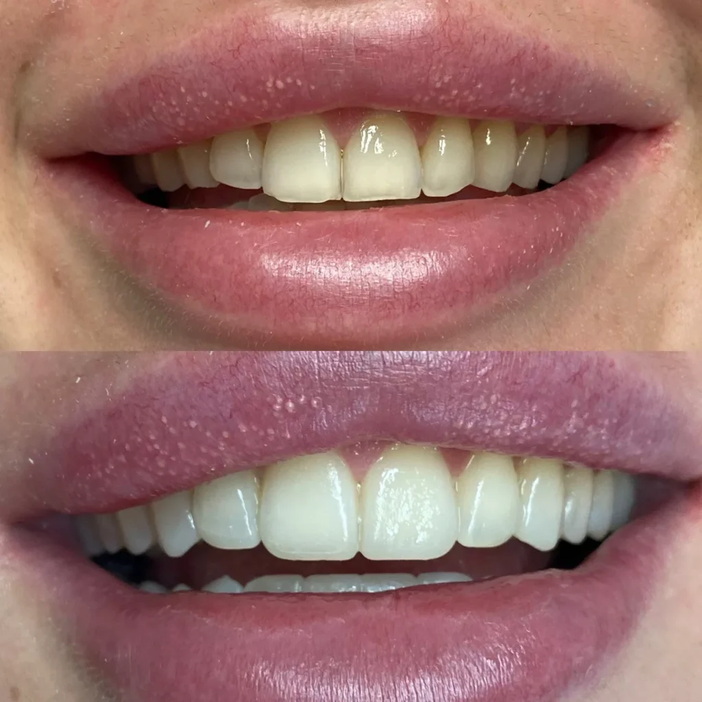 Линия улыбки Портфолио